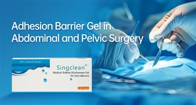 Adhesion Barrier Gel hauv Kev phais plab thiab Pelvic: Cov ntaub ntawv pov th...